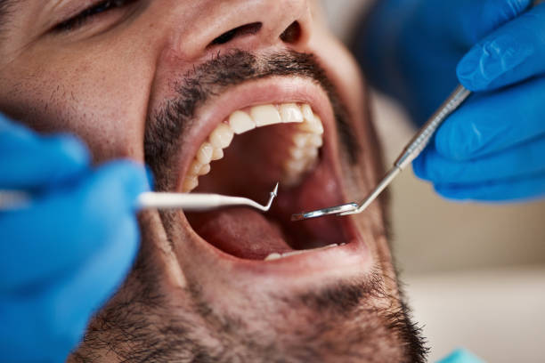 Best Mobile Emergency Dentist in Lake Arbor, MD